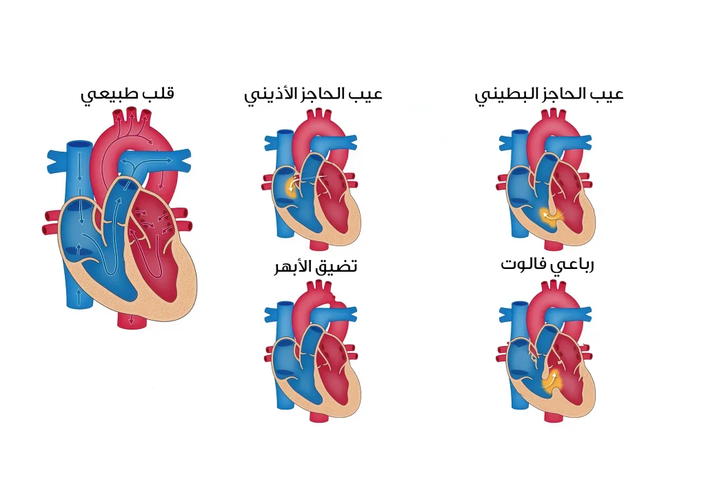 العيوب الخلقية