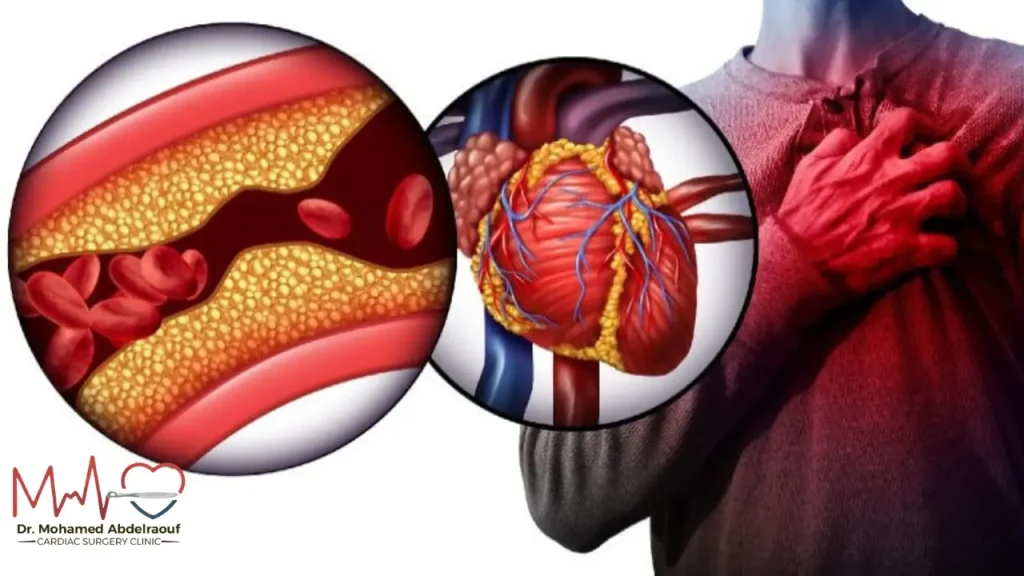 ما هو القصور فى الشريان التاجى؟