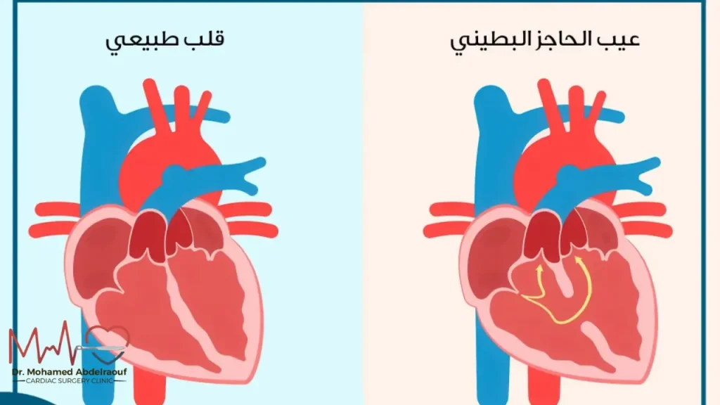 ما هي أنواع العيوب الخلقية في القلب؟